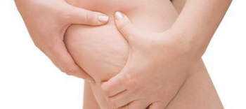 rétention d'eau